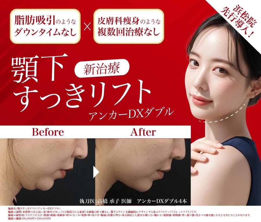 話題の新治療【顎下すっきリフト】とは？二重あご・たるみ改善の効果・脂肪吸引との違い・ダウンタイム・持続性を徹底解説！