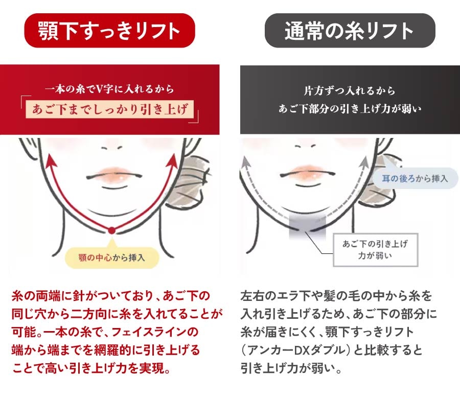 構造の違い