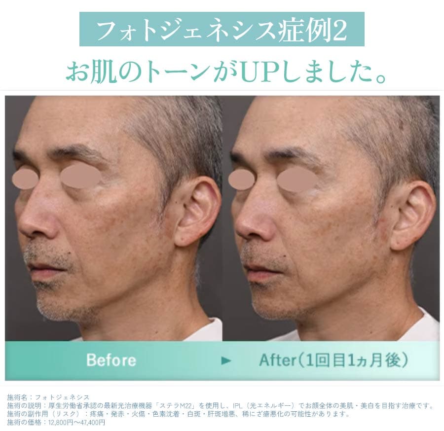 症例①