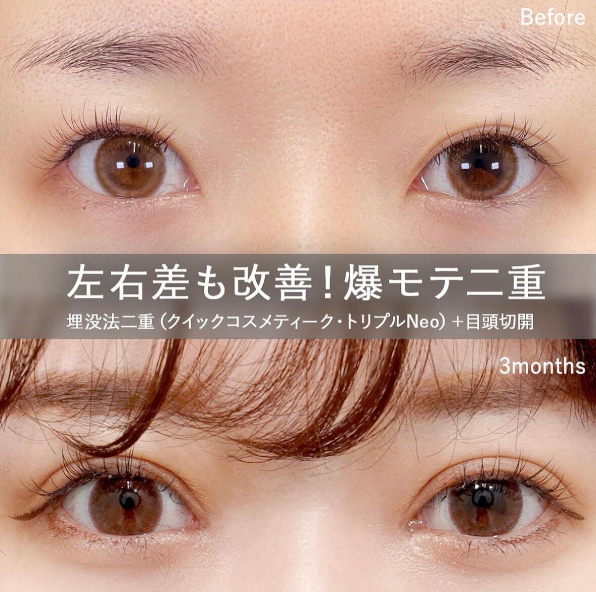 目の左右差が気になる