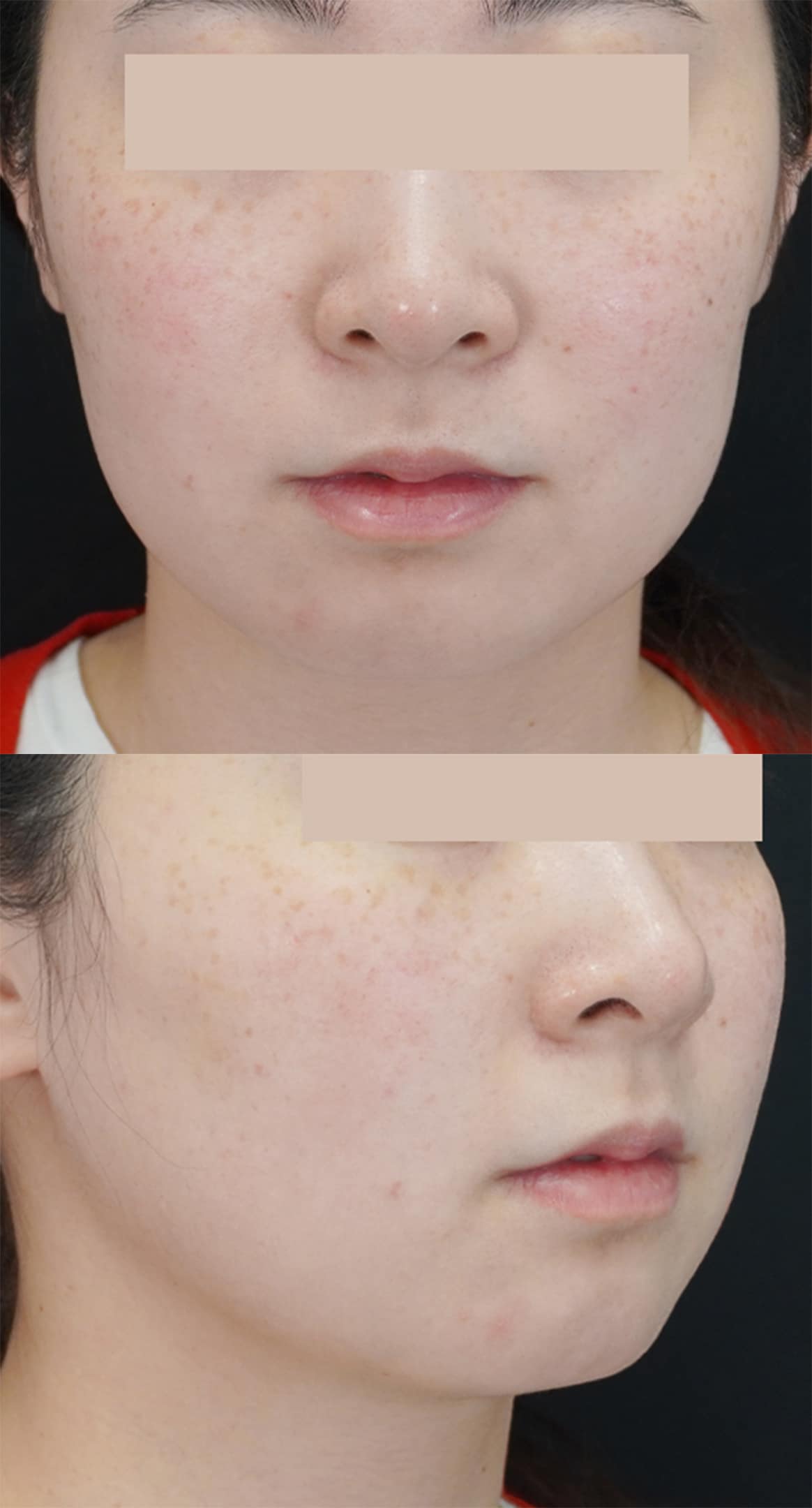 タレント級の小顔を手に入れる!