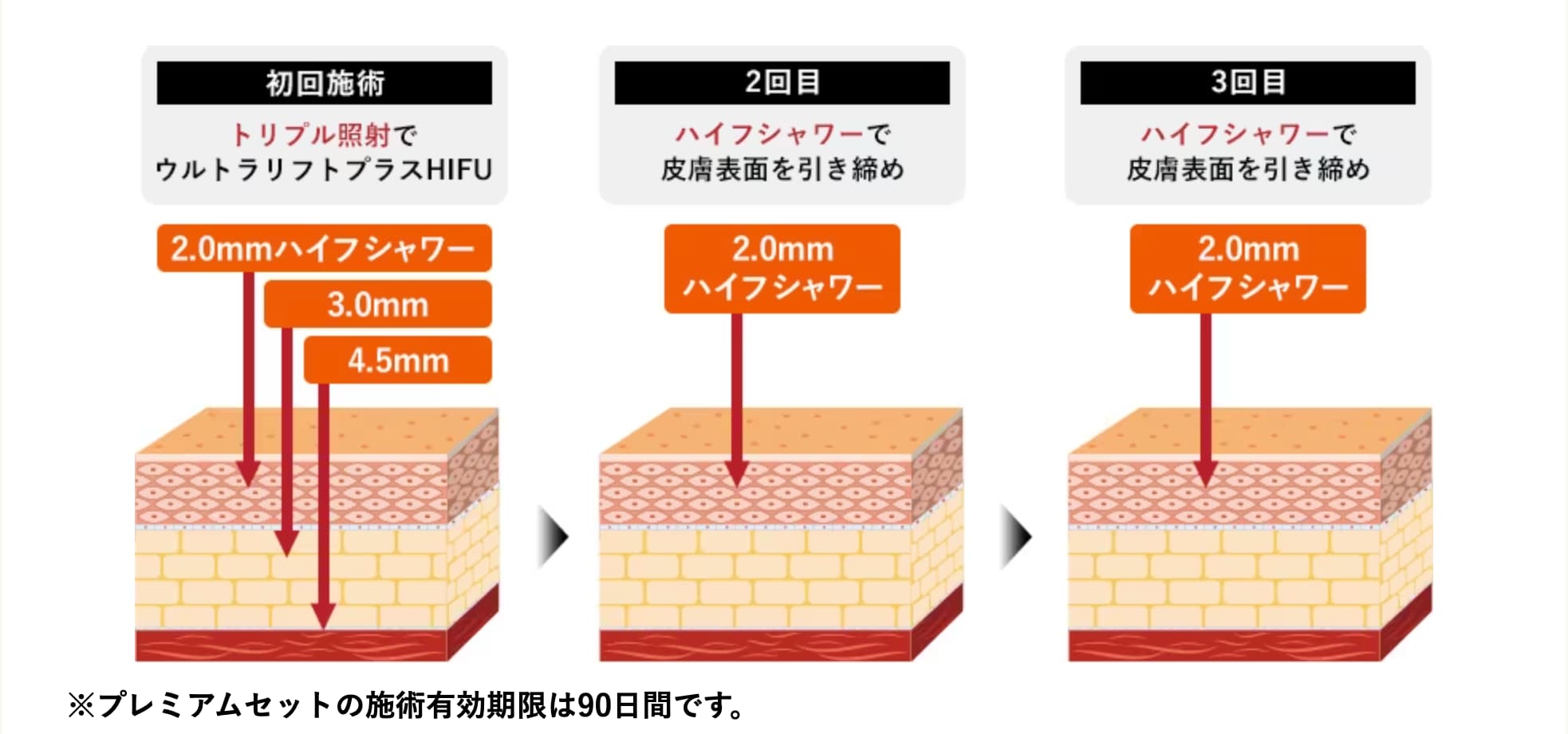 HIFUが1回とHIFUシャワーが2回行えるお得なセットメニューです