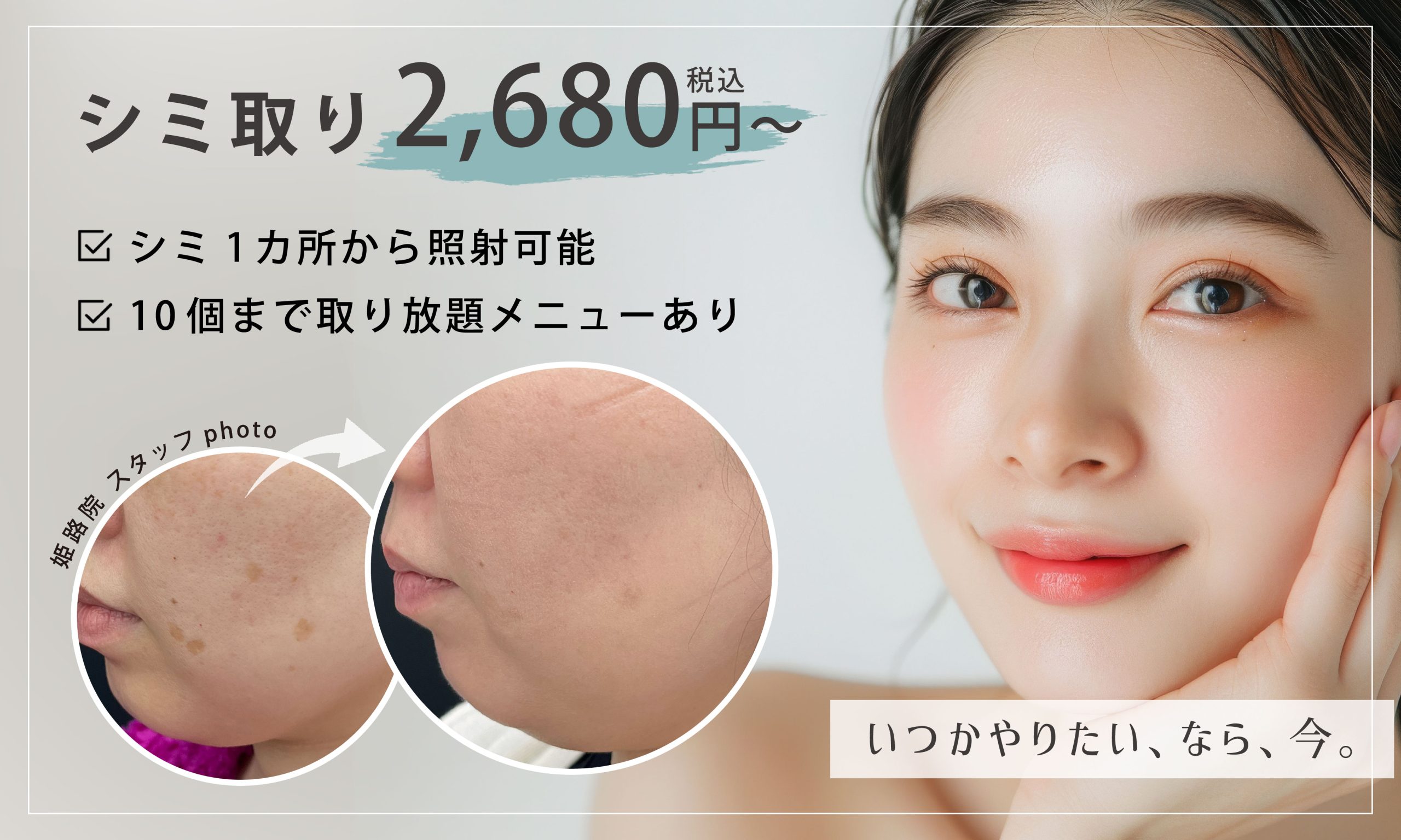 シミ取り2,680円〜！姫路でシミ治療するならSBC姫路院