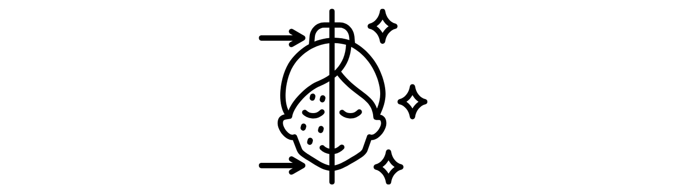 ニキビがある方へ