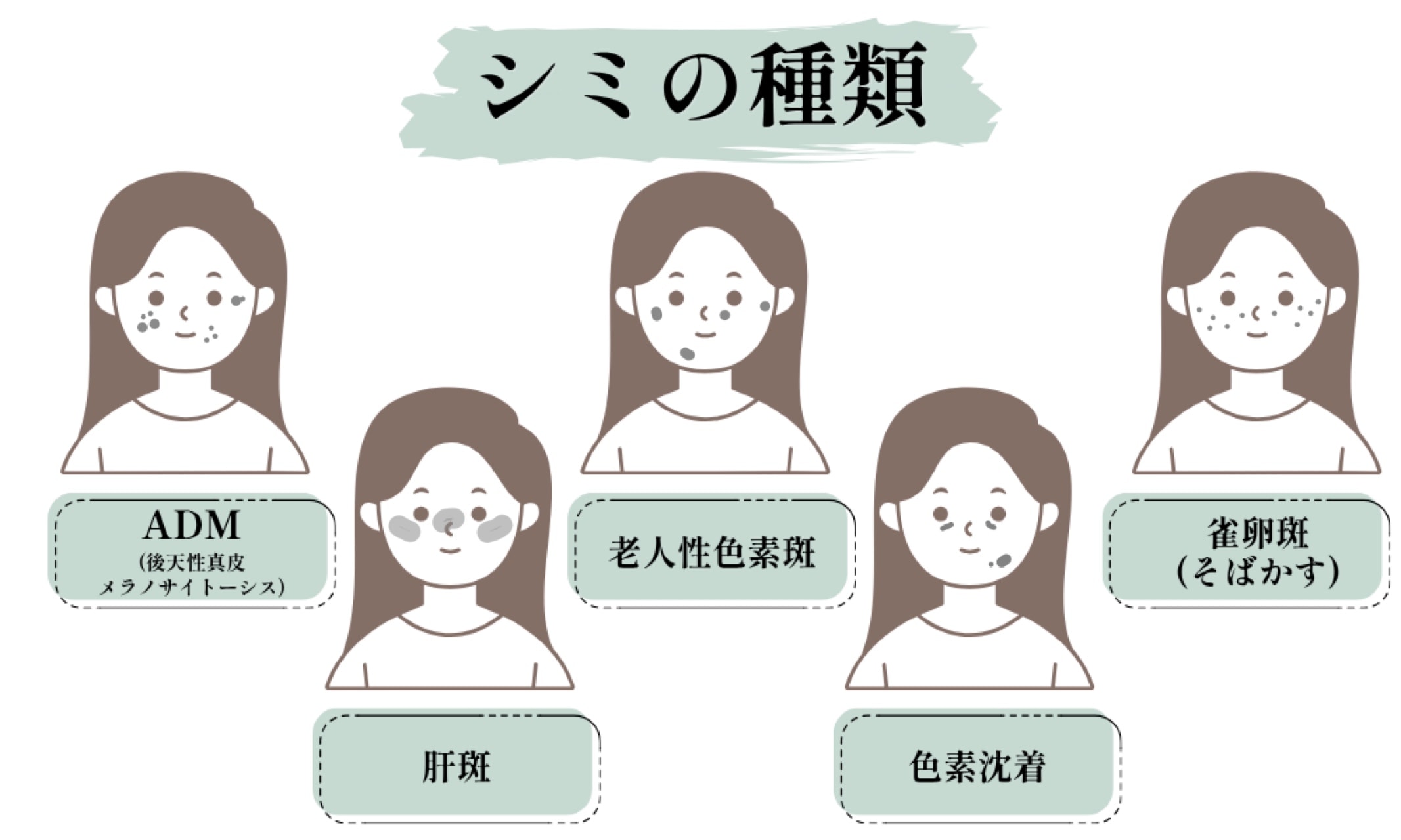 全部で5種類