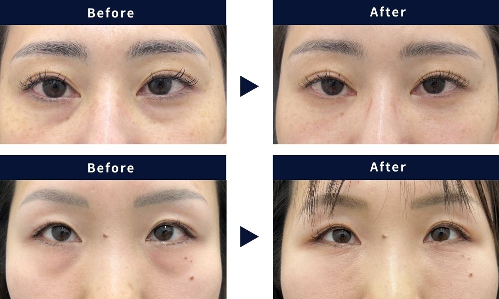 30代　女性
