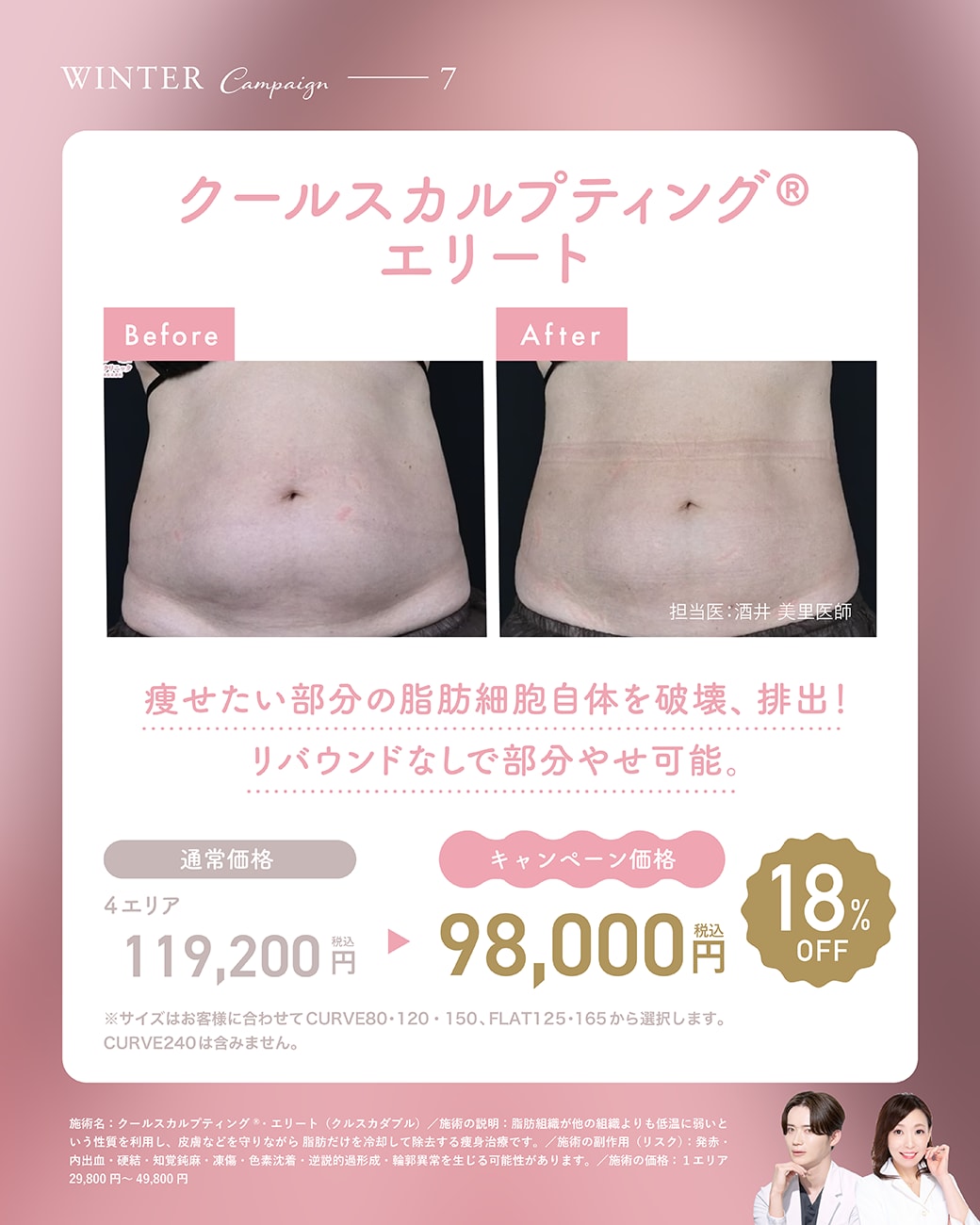 【取り扱い施術⑦】クールスカルプティング®エリート