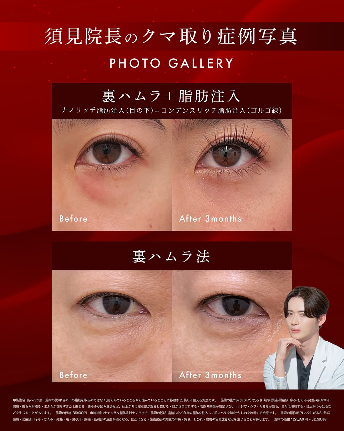 症例の特徴