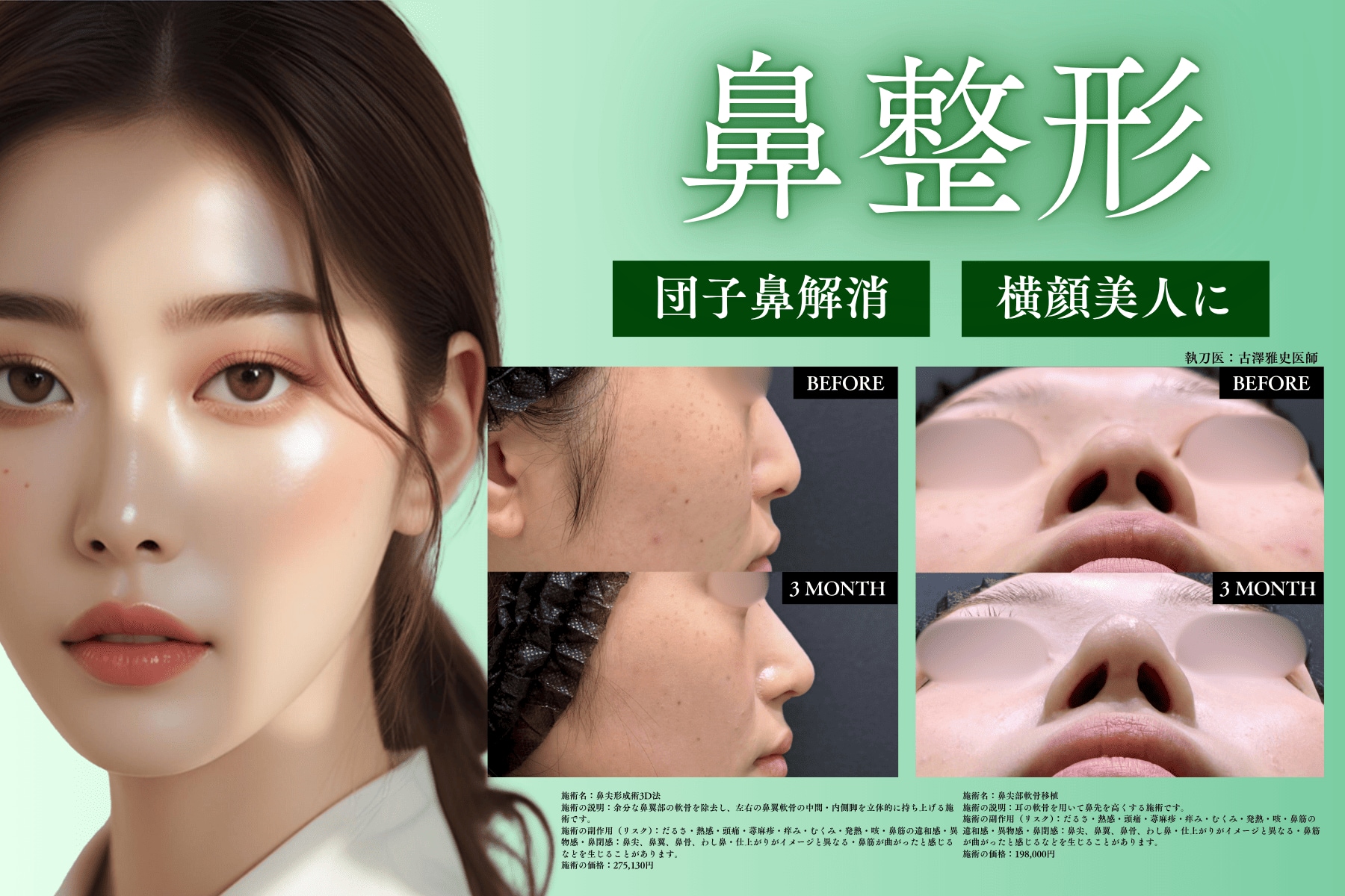 鼻整形