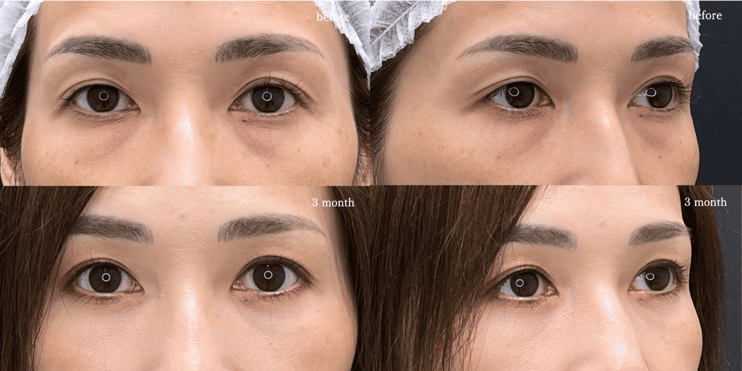 番組でご紹介した症例③