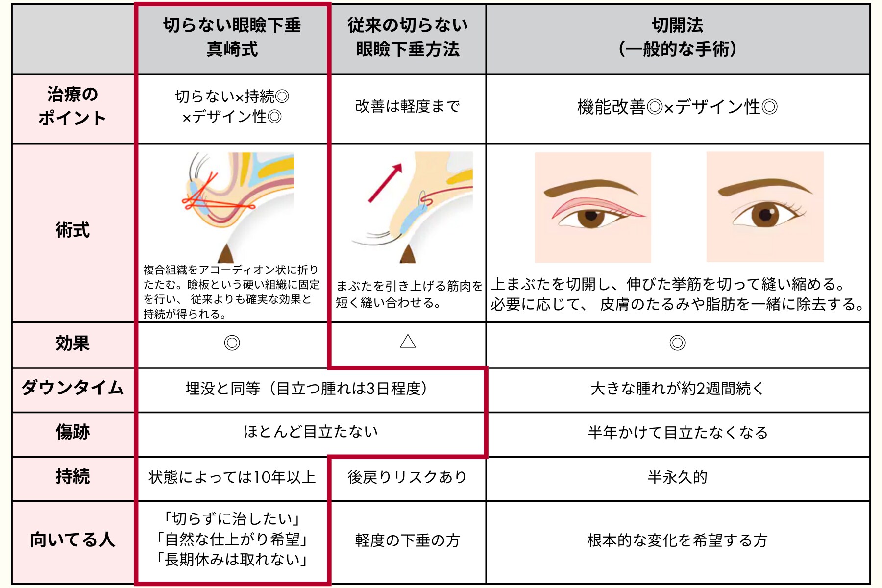 術式の違い