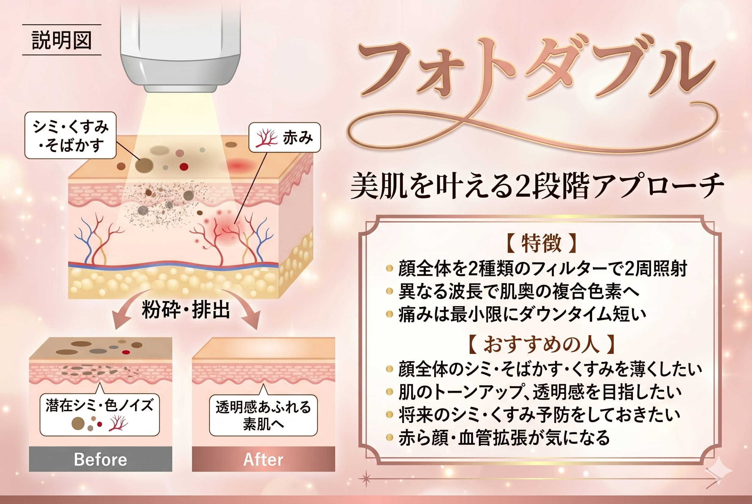色ノイズがない、均一な肌へ