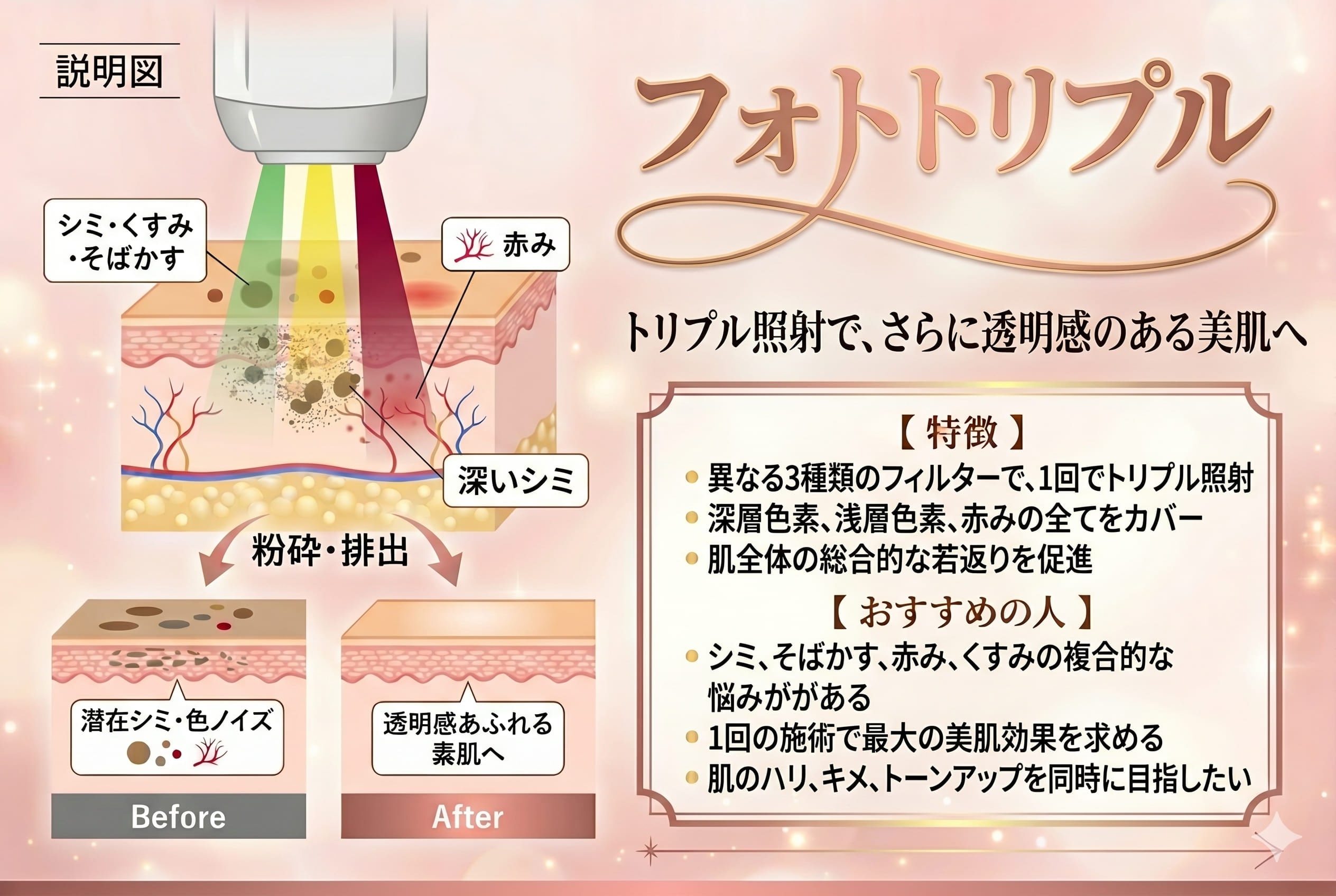 濃いシミにも同時アプローチ！ ※今後導入予定