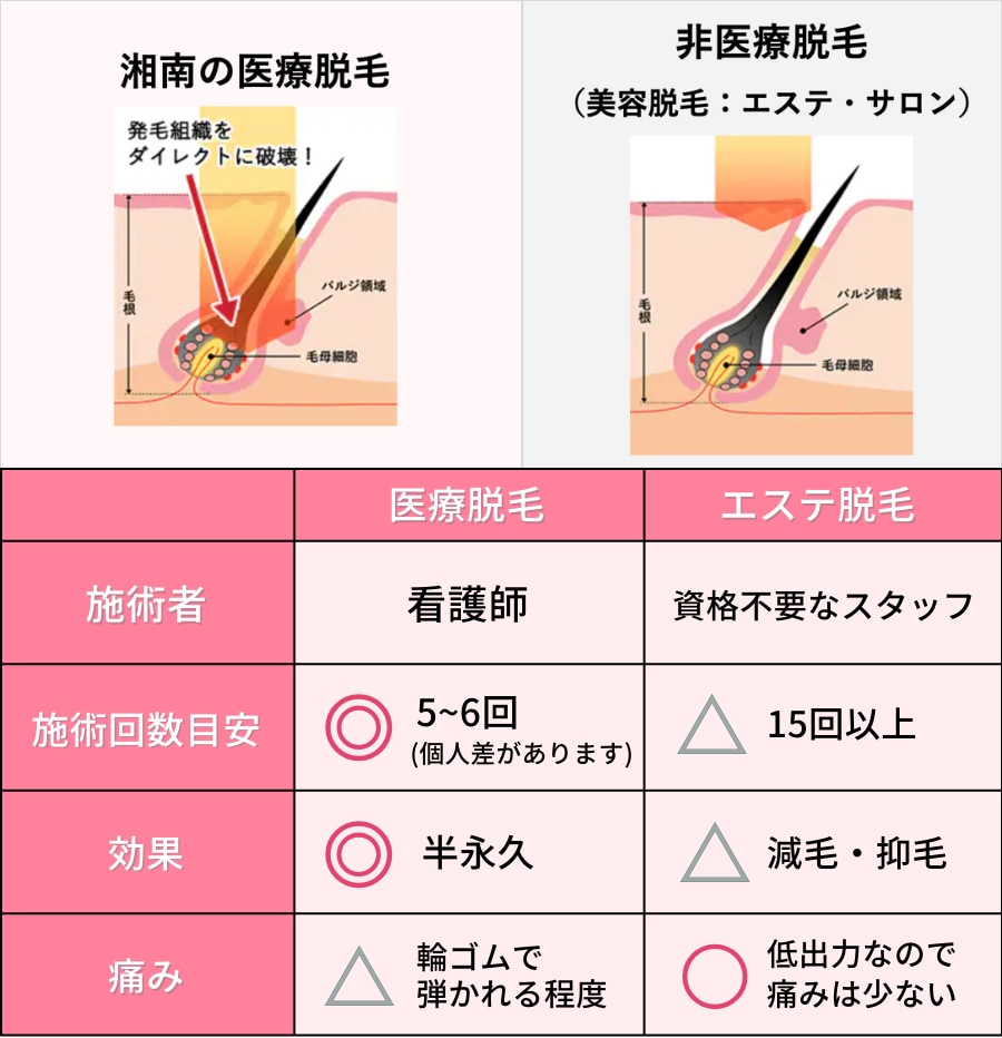 比較