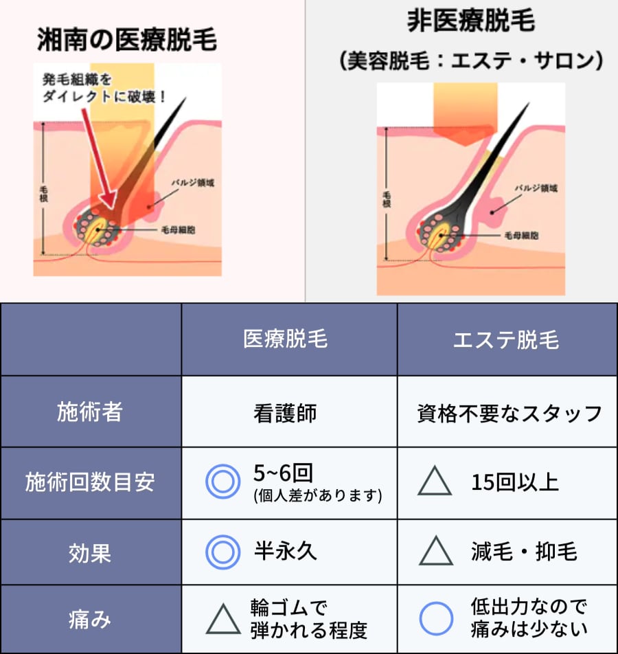 比較
