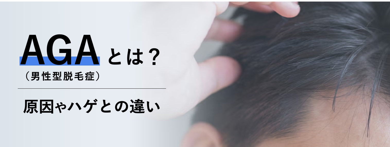 AGA=「Androgenetic Alopecia」