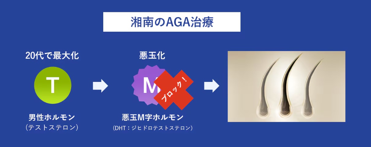 湘南のAGA治療薬なら体の内側から直接<br />
悪玉M字ホルモンをブロック！