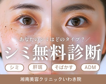 いわき市のシミ取り・そばかす・肝斑治療なら湘南美容クリニックいわき院|美容皮膚科