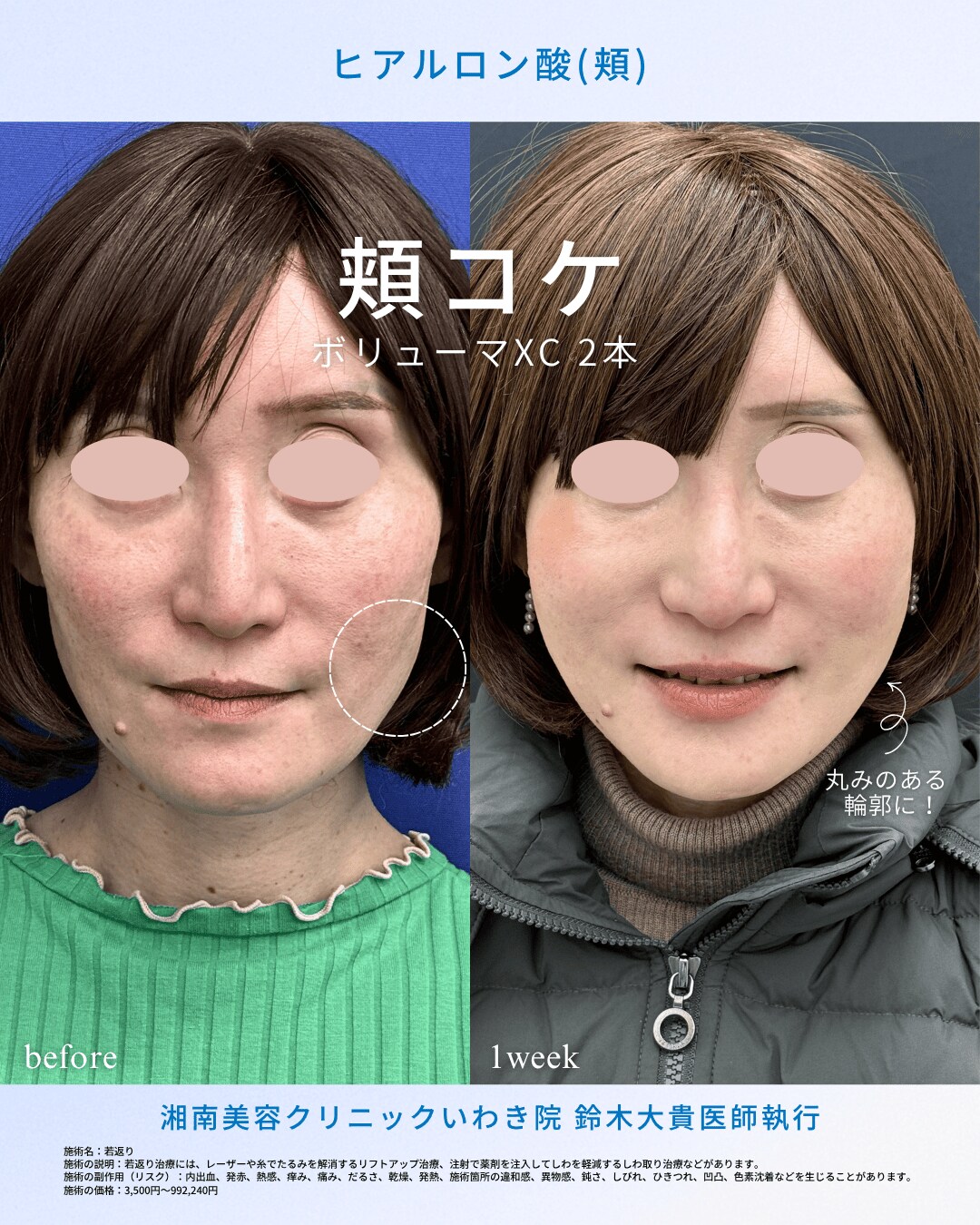 トータルバランスで「垢抜け顔」へ