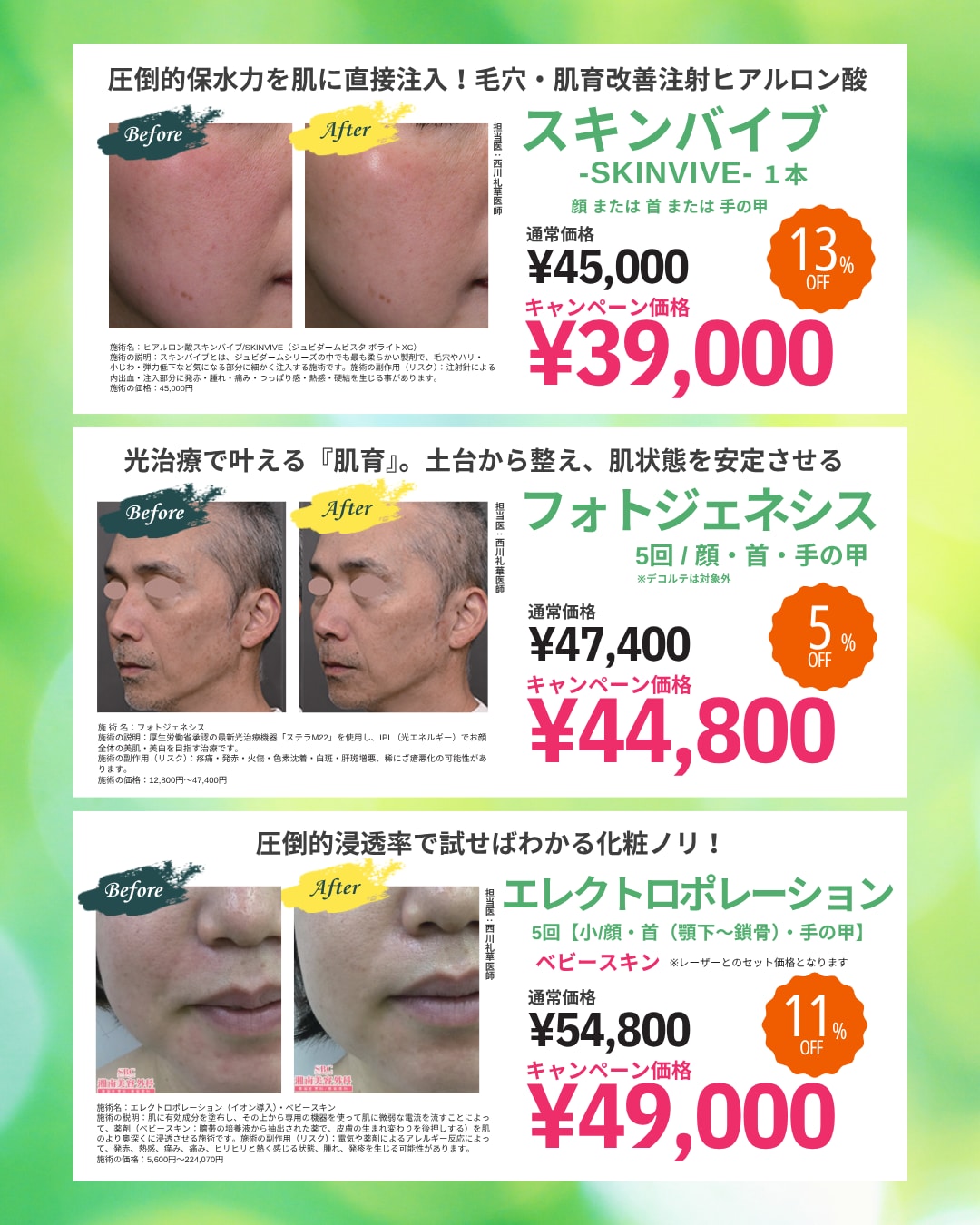 5月の皮膚科施術キャンペーン周知【湘南美容クリニックいわき院】