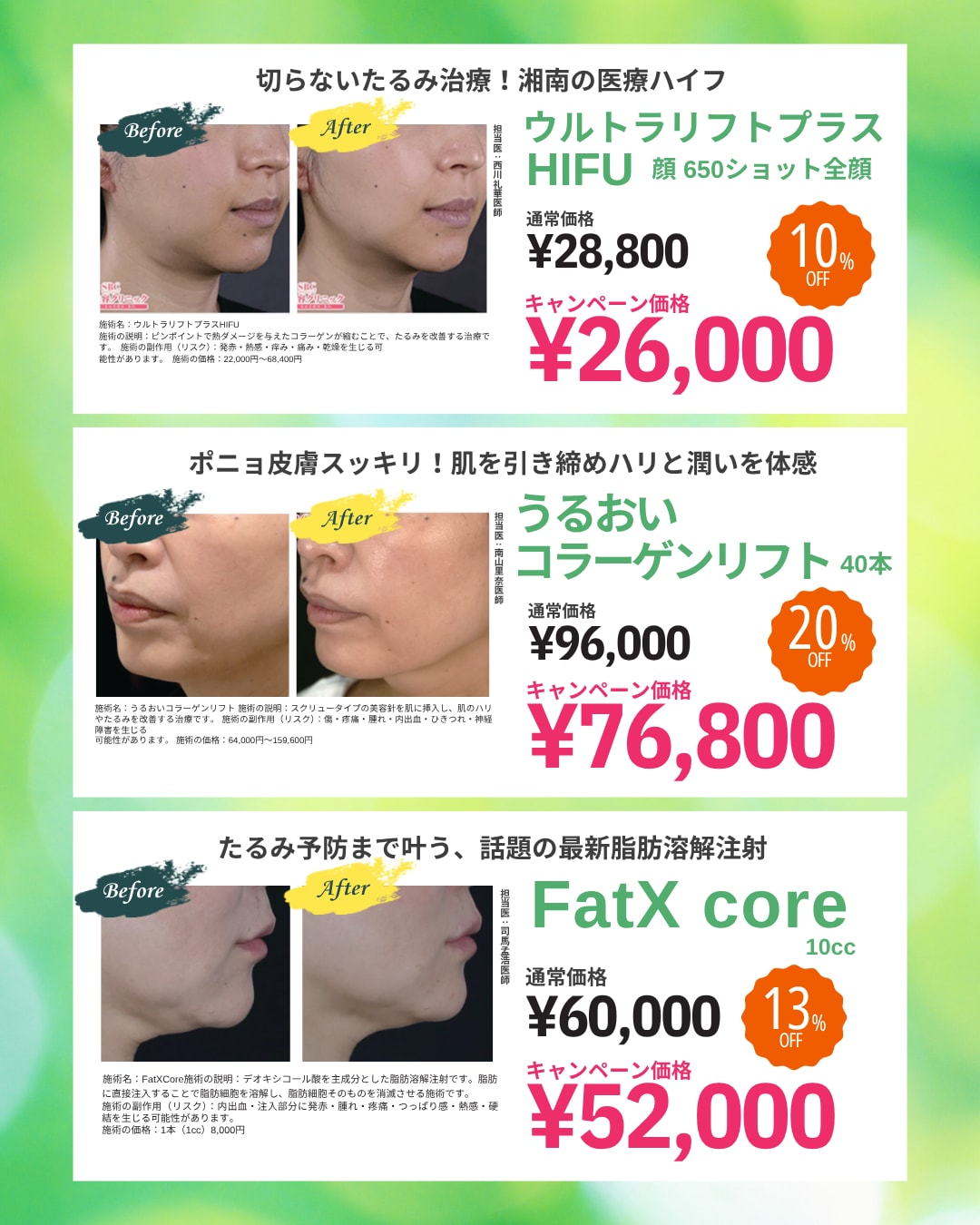 5月の皮膚科施術キャンペーン周知【湘南美容クリニックいわき院】