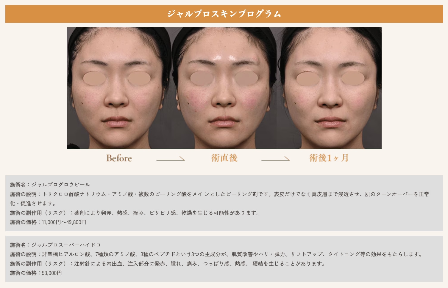 ジャルプログロウピール症例【湘南美容クリニックいわき院】