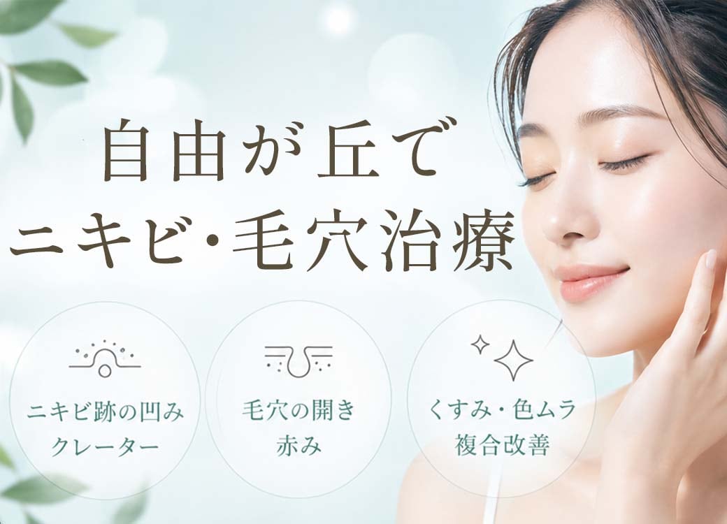 ニキビ・毛穴治療を自由が丘でするなら症例数12万件以上のSBC自由が丘院