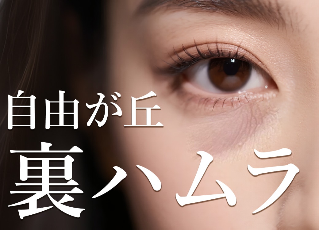 【野水医師解説】自由が丘の裏ハムラ法！切らないクマ取りとの違い|目黒区・世田谷
