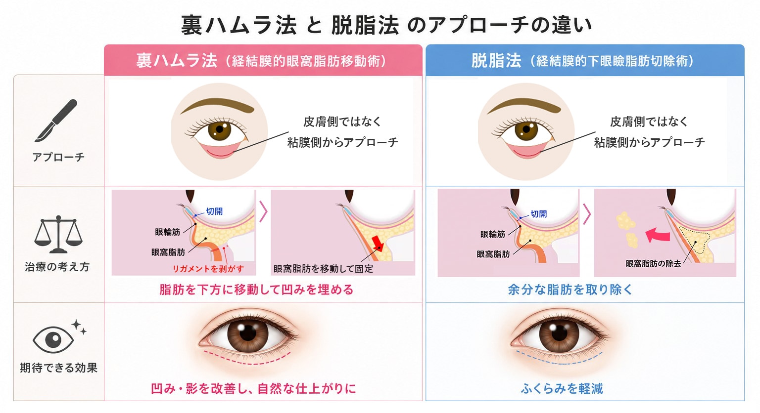 目の下の切らないクマ・たるみ取り（脱脂）との違い