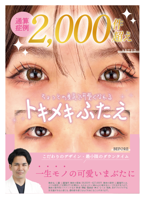 通算2000件以上執刀！かわいい二重を日々作成中★