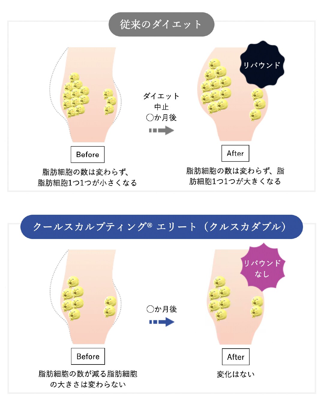 脂肪冷却で脂肪細胞自体の数を減らすから「リバウンド」なし！