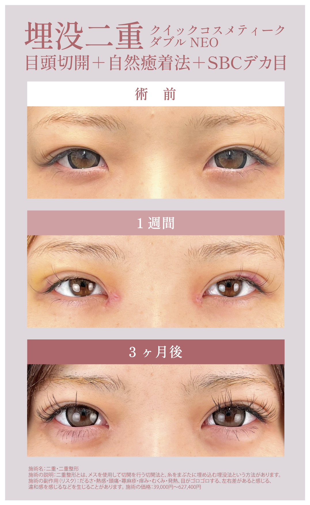 4種複合！