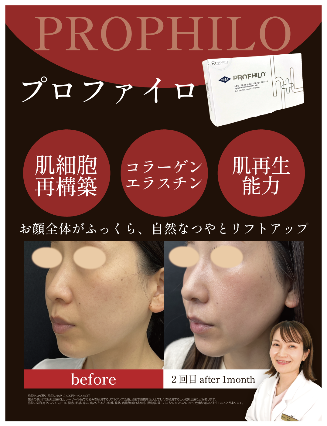 プロファイロ