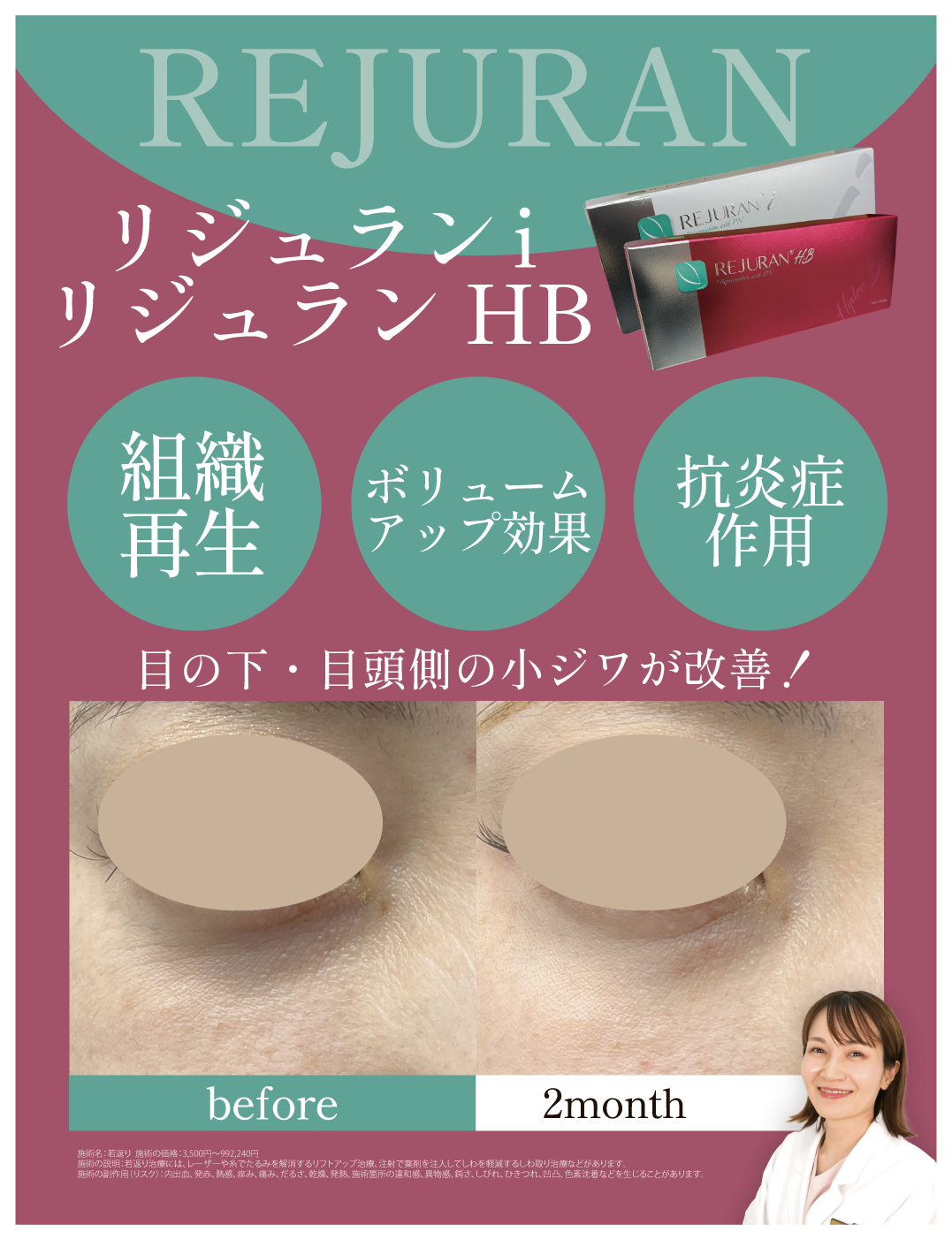 リジュラン