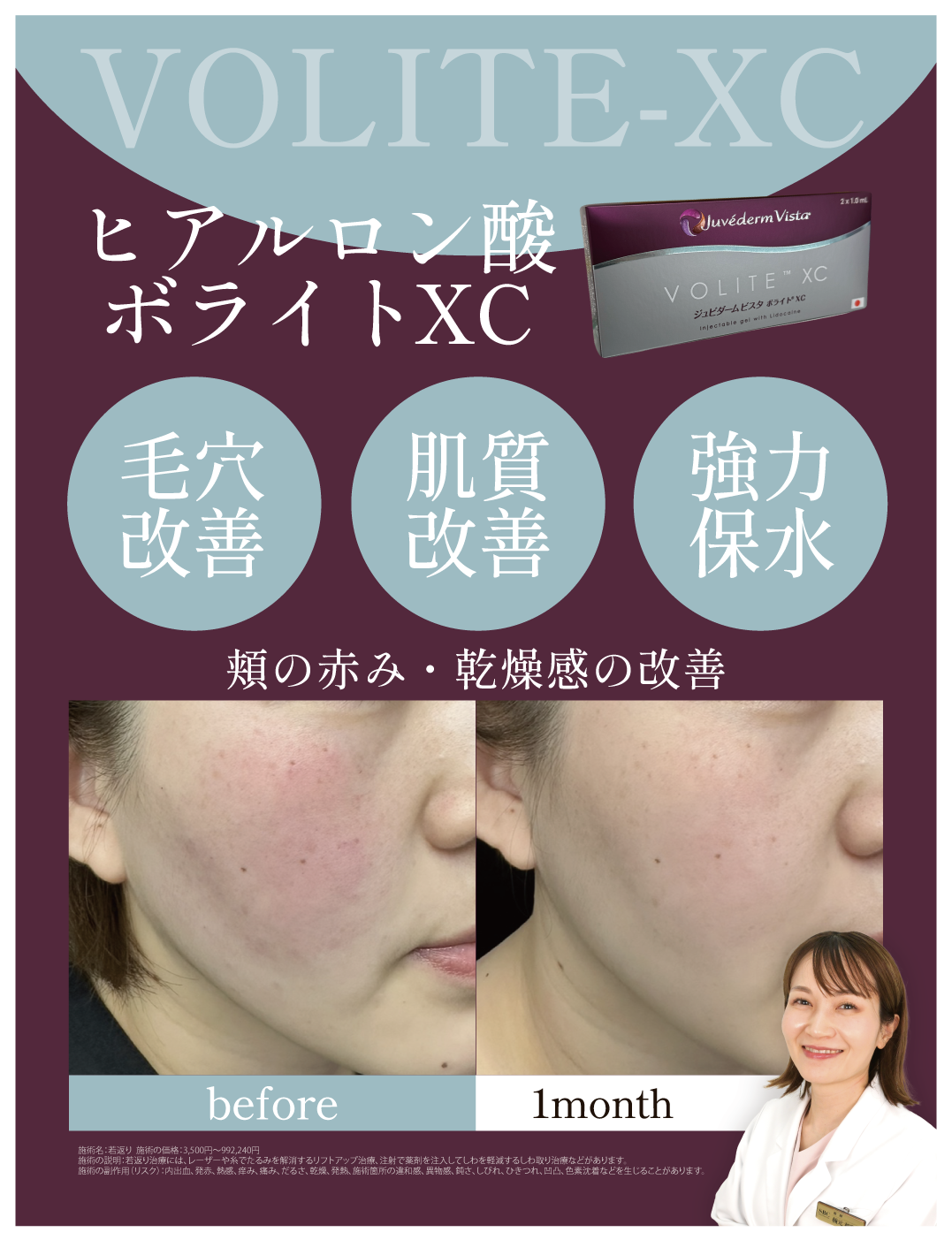 ボライトXC