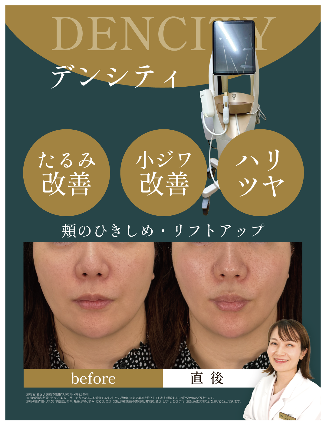 デンシティ