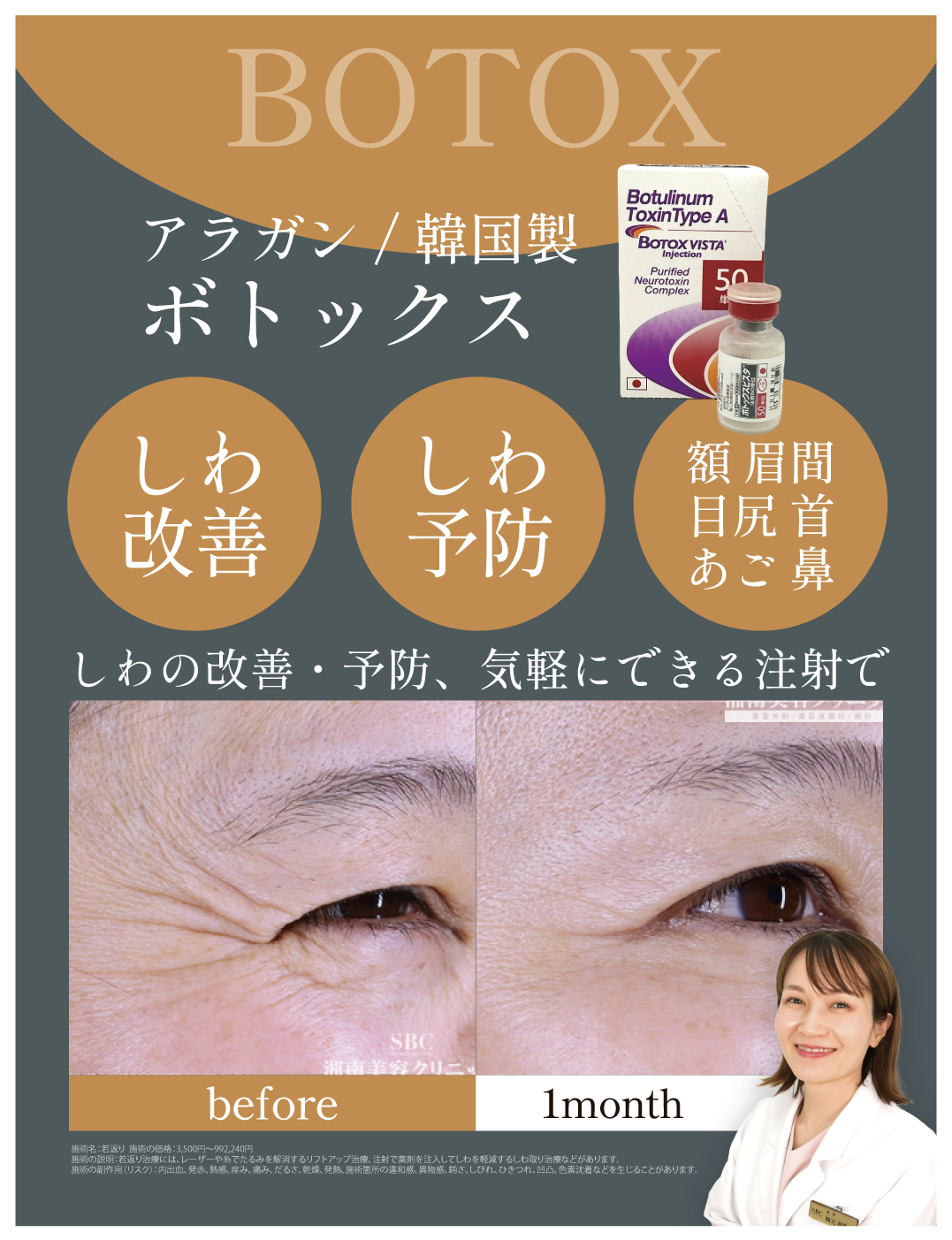 ボトックス