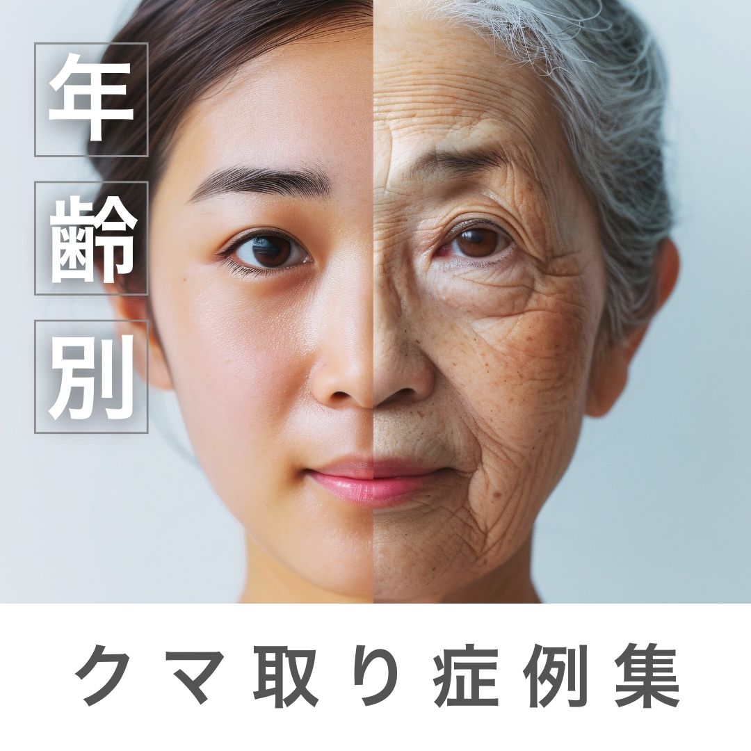 【年齢別】湘南美容クリニック蒲田院・上岡利一院長のクマ取り症例集｜10代〜70代を徹底解説！羽田空港から最短で全国から指名殺到の理由とは？