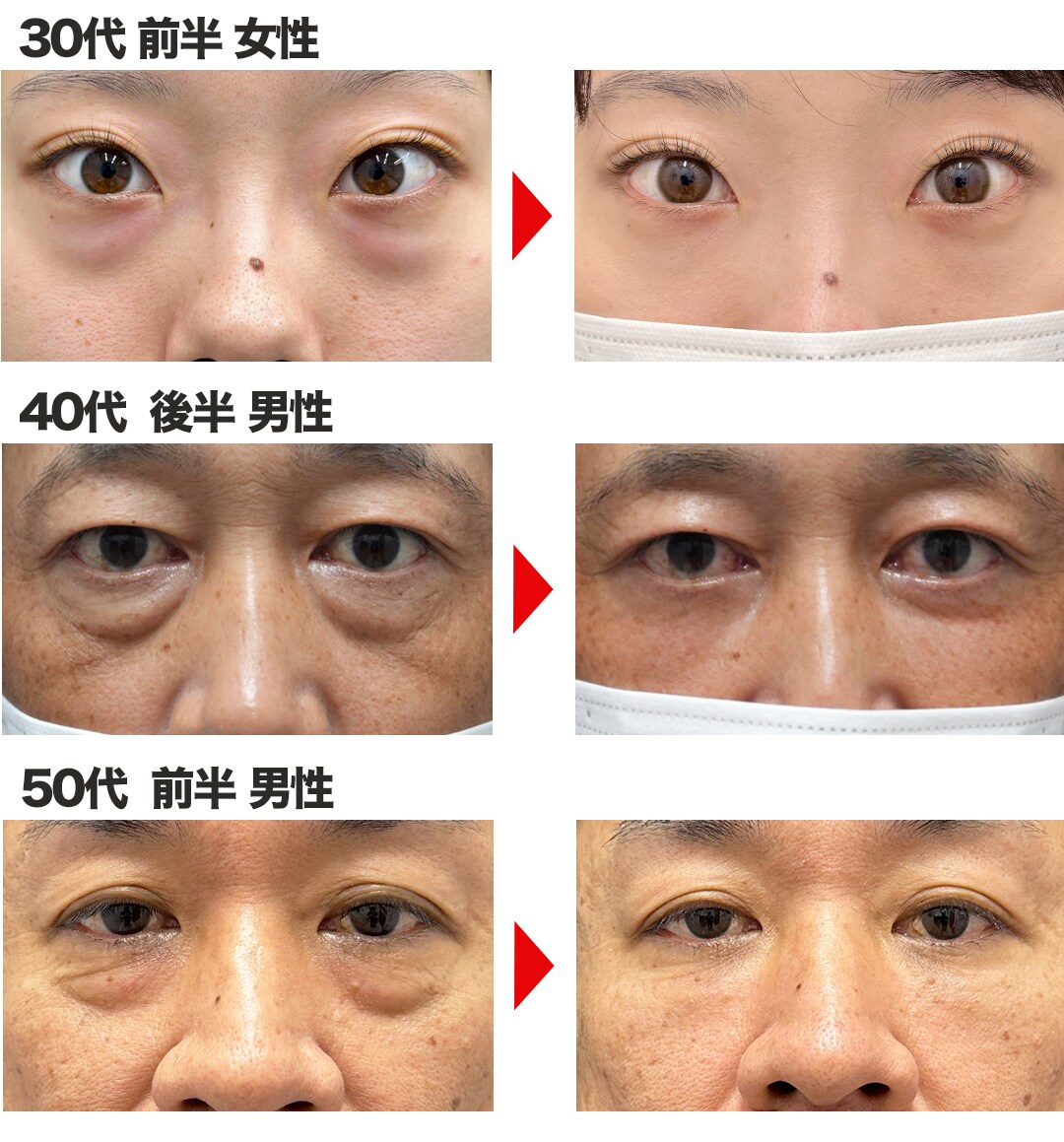 脱脂集
