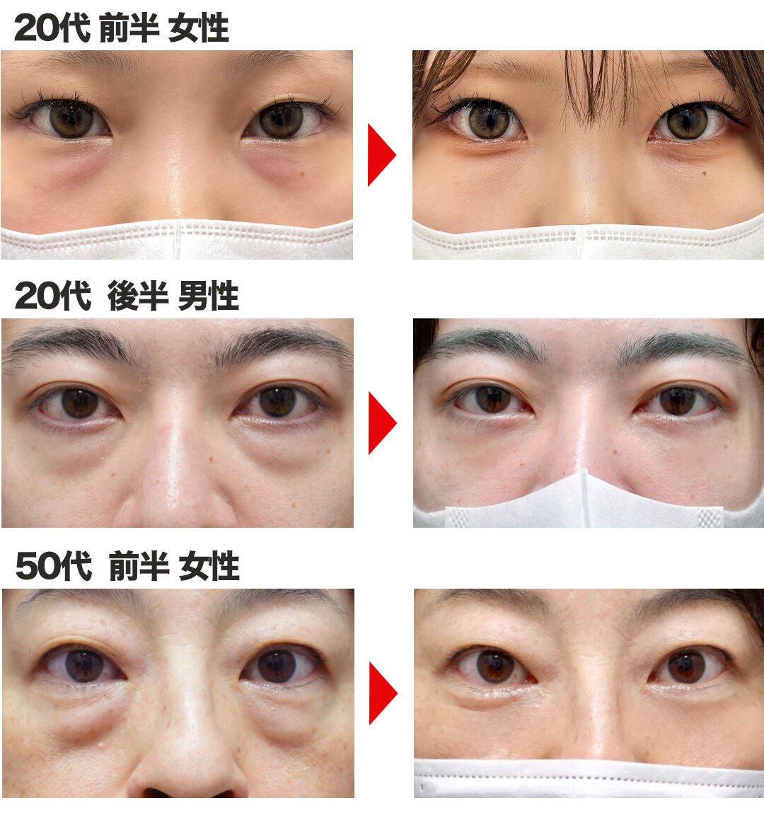 裏ハムラ集