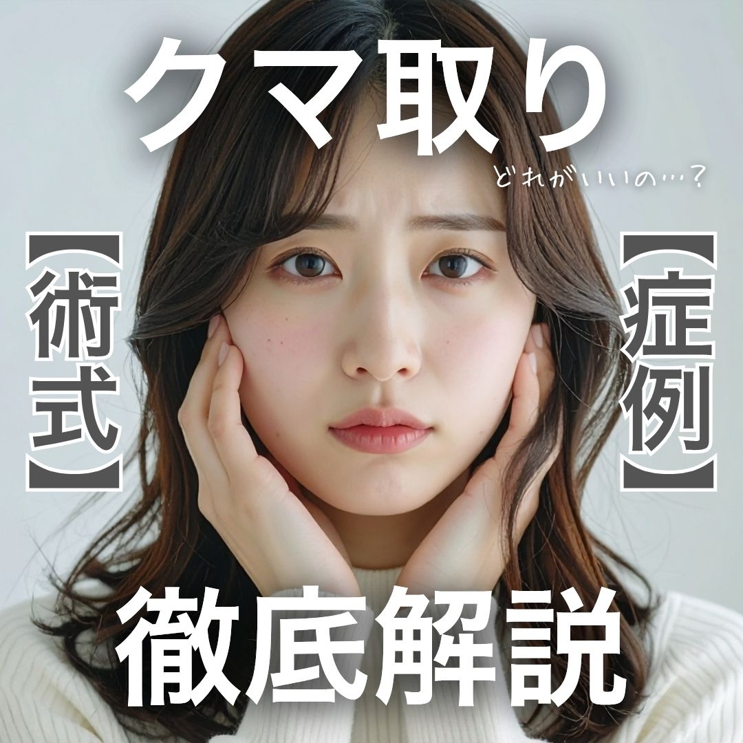 【クマ取り・裏ハムラの名医】湘南美容クリニック蒲田院・上岡利一院長が選ばれる理由｜失敗しない術式の選び方と症例解説