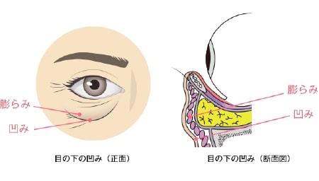 クマは膨らみと凹みが同時に存在している