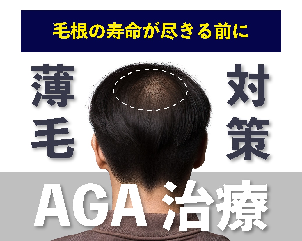 AGA