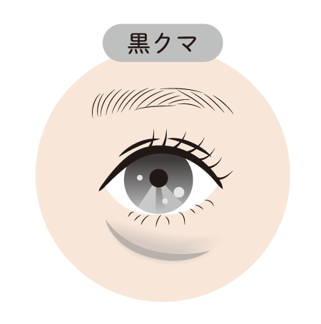 【黒クマ（影クマ）の治療】