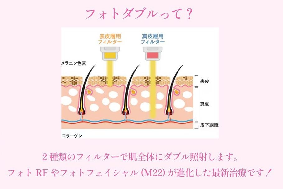 フォトダブルとは？