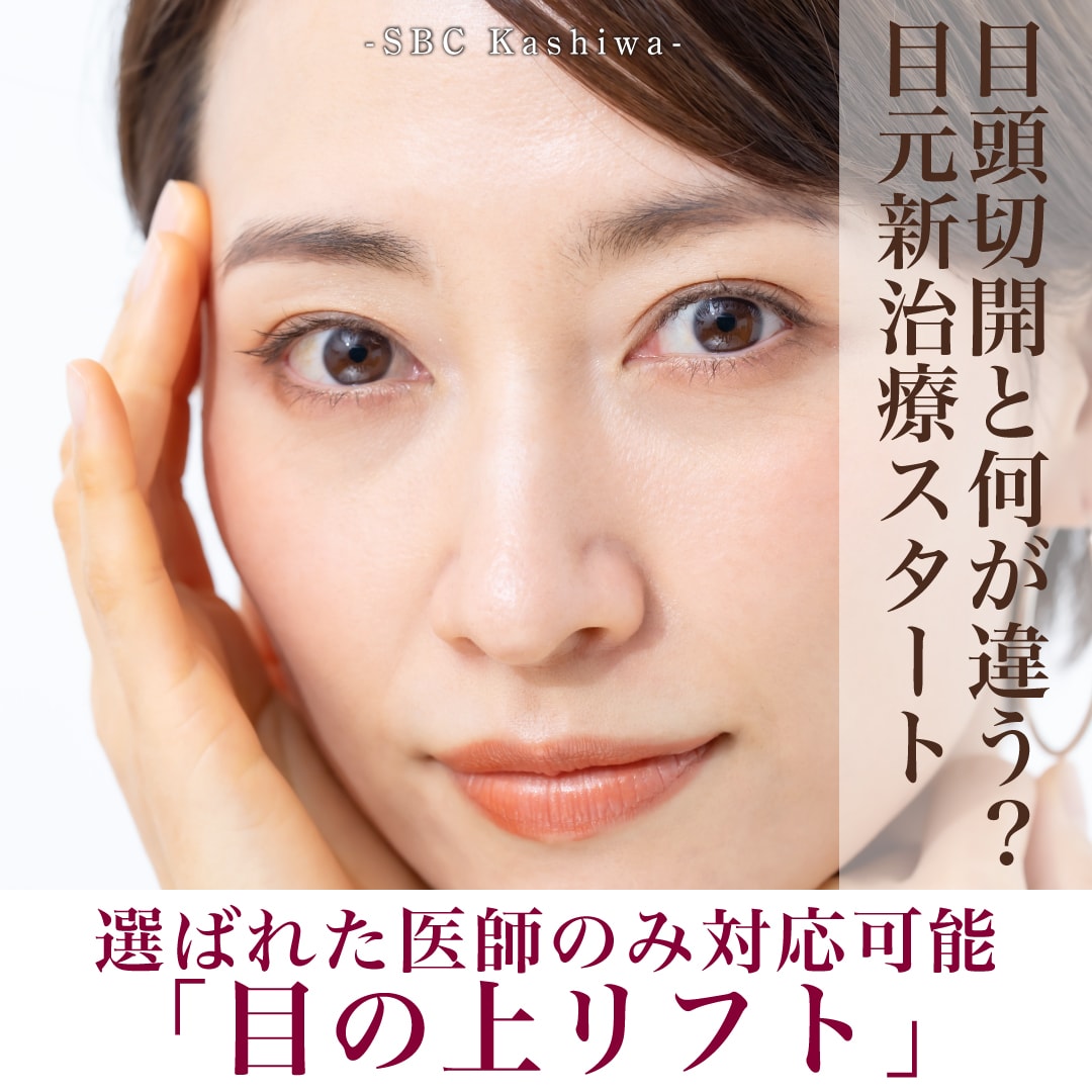 目頭切開と何が違う？「目の上リフト」が選ばれる理由とメリット【柏院新治療スタート】