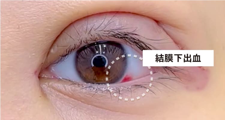 主な症状③その他