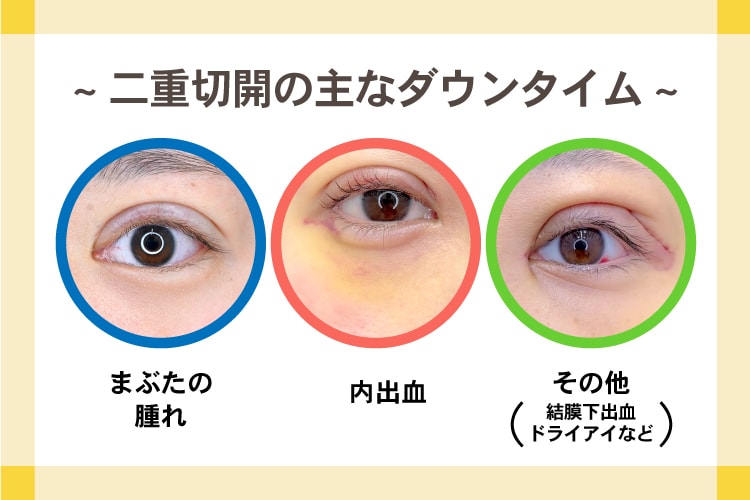 一般的な症状