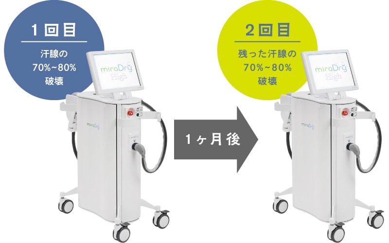 80%以上の効果を期待するなら複数回照射がおすすめ