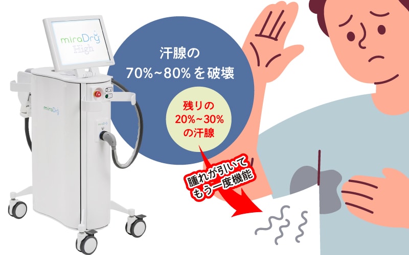「再発」の原因
